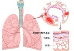 职业性哮喘诊断方法有哪些